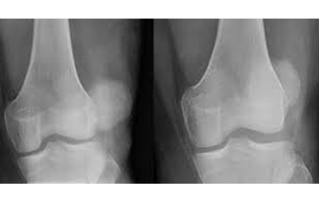 Trick knees and bunny hops!